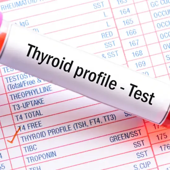thyroid comprehensive panel